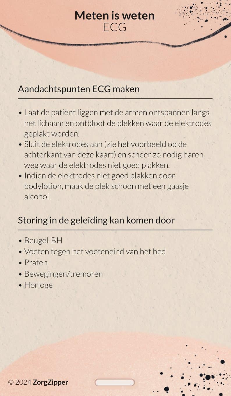 Meten is weten: ECG, achterkant
