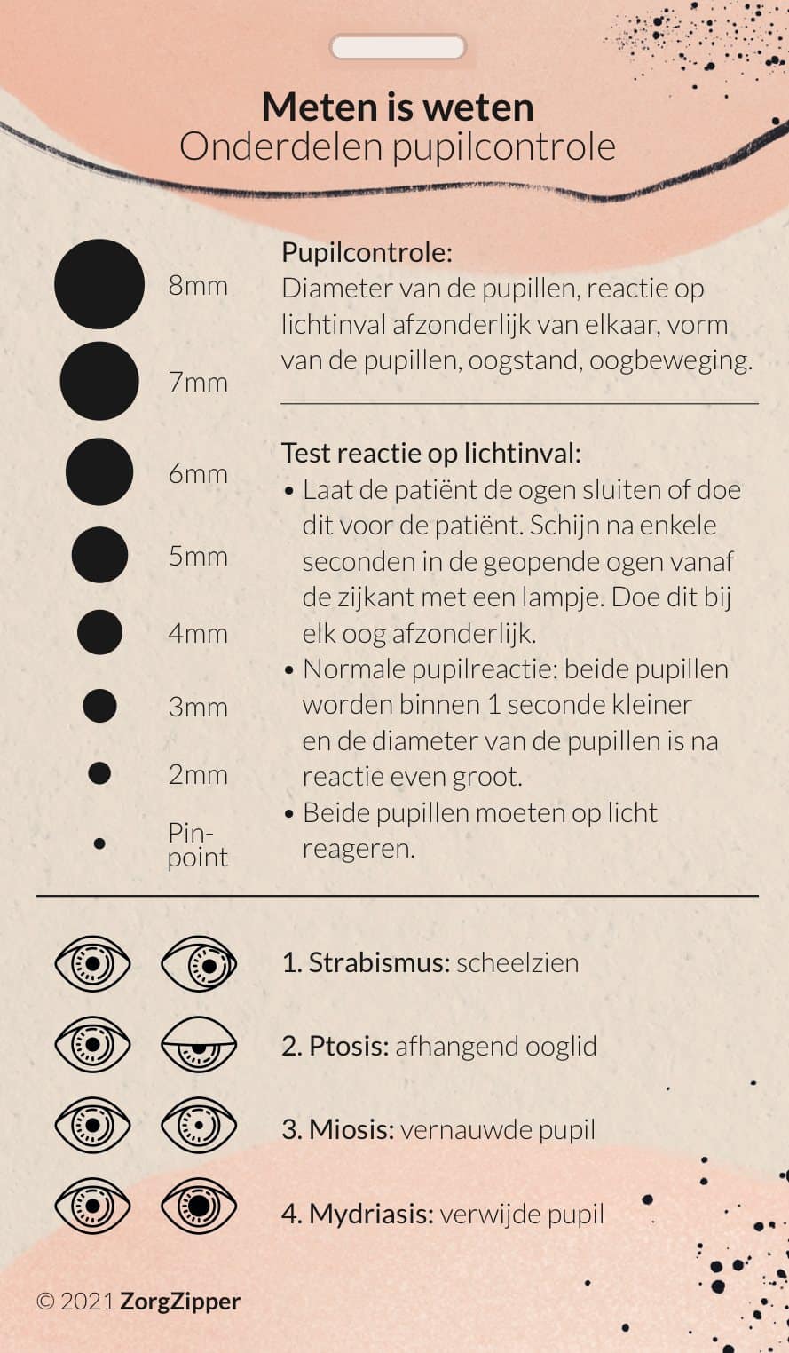 Meten is weten: MRC & pupilcontrole, achterkant