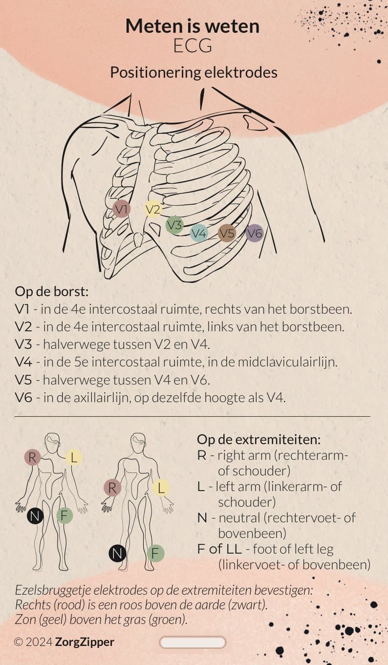 Meten is weten: ECG