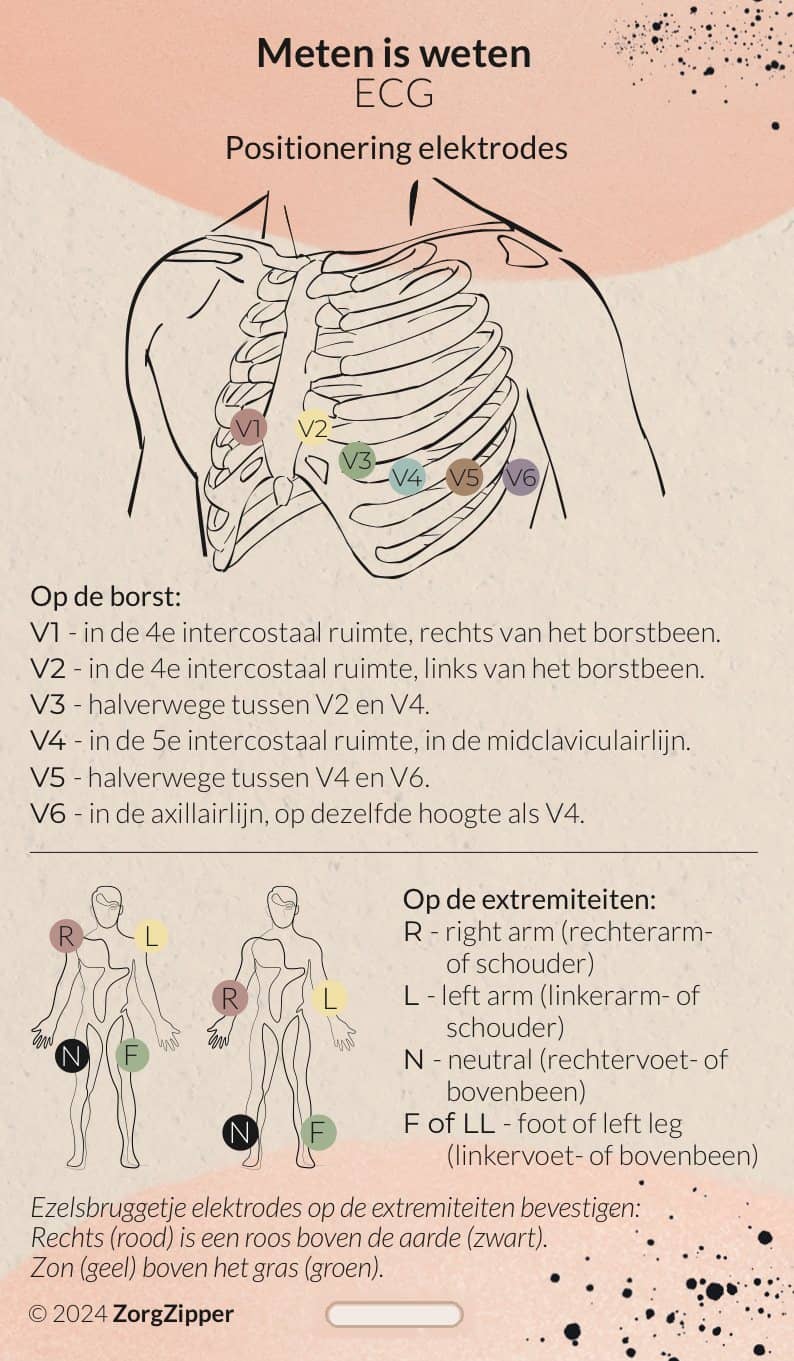 Meten is weten: ECG